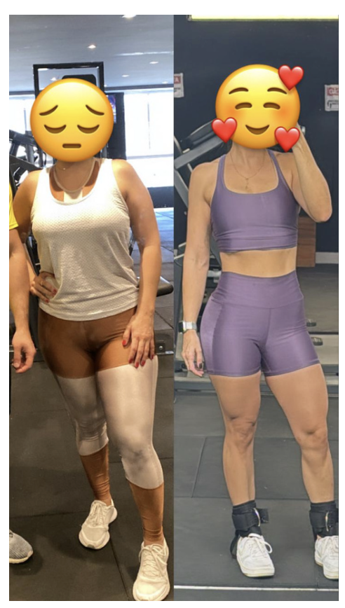 Antes e Depois 2