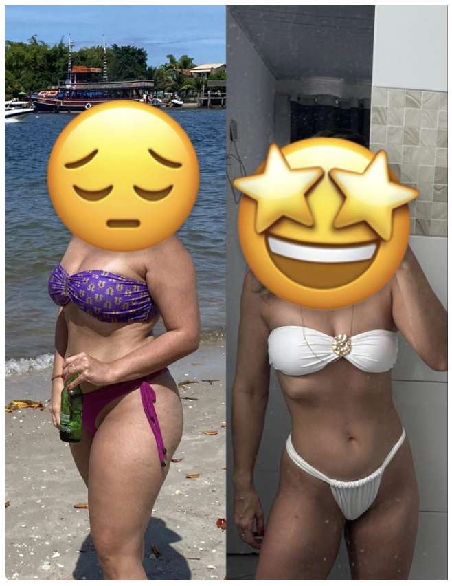 Antes e Depois 3